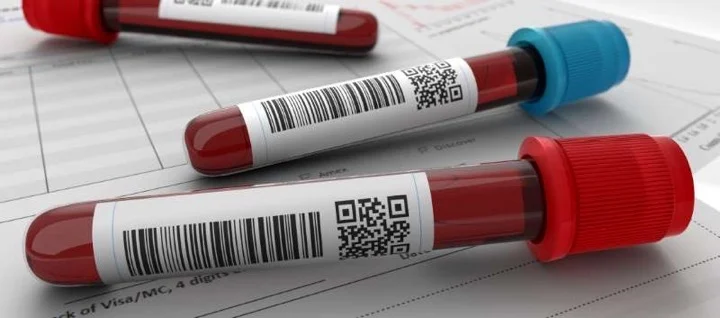 7دلیل مهم برای انجام آزمایش پتاسیم خون