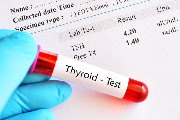 اهمیت آزمایش TSH (هورمون محرک تیروئید)